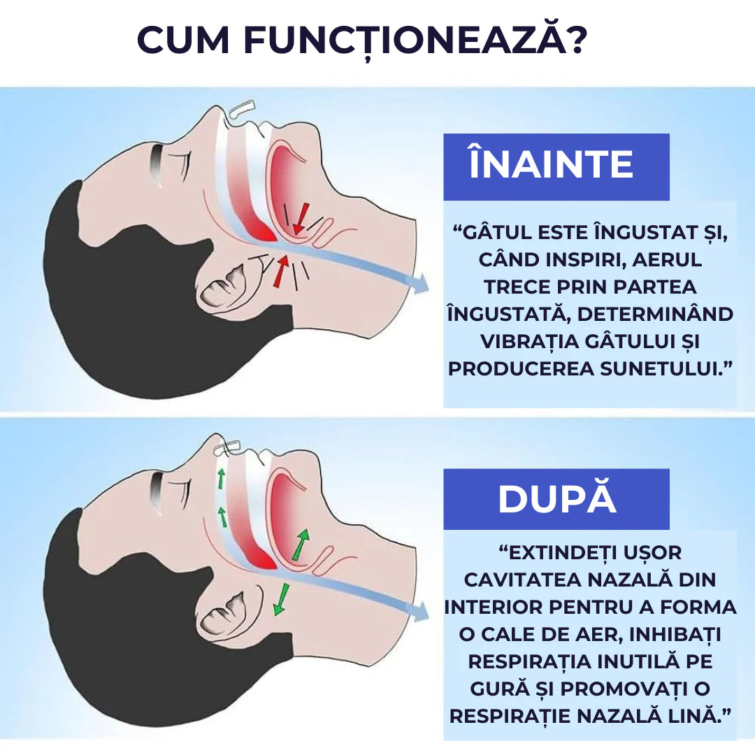 SNORFIX: Inel Anti Sforait + 1 Cadou